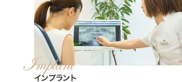 インプラント
