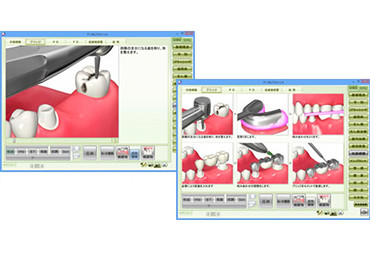 カウンセリングツール　デンタルフラッシュ　画像