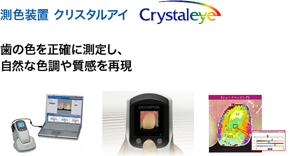 測色装置 クリスタルアイ　歯の色を正確に測定し、自然な色調や質感を再現