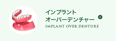 インプラントオーバーデンチャー