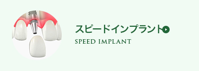 スピードインプラント