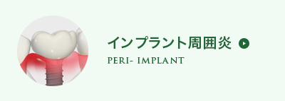 インプラント周囲炎
