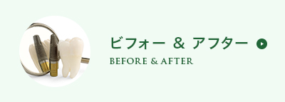 ビフォー&アフター