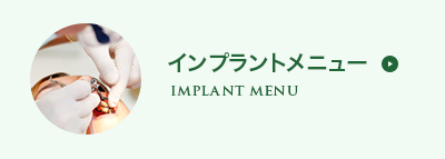 インプラント料金表