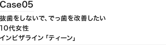 Case05 抜歯をしないで、でっ歯を改善したい