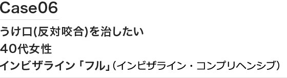 Case06 うけ口(反対噛合)を治したい
