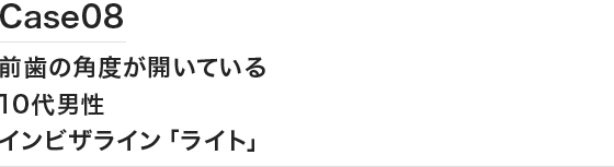 Case08 前歯の角度が開いている